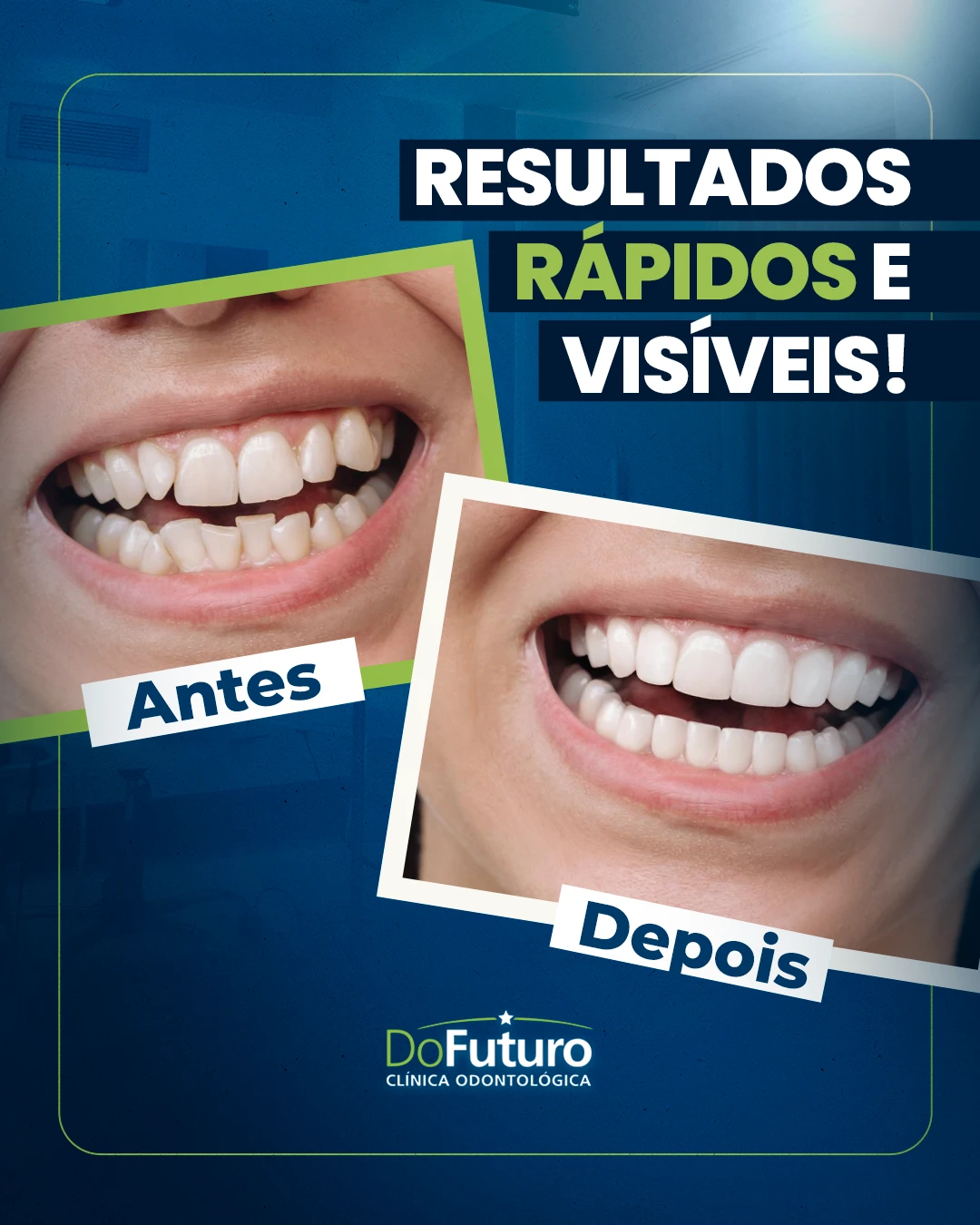 Seu sorriso pode mudar mais rápido do que você imagina! | Clínica do Futuro